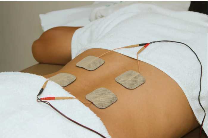 Interferential Therapy Electrodes on Patient Back